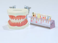 歯模型
